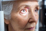 All About the Eye Disease Glaucoma
