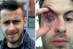 contact lens, contact lens users, contact lens wearers beware man goes blind after parasites eat man s eye as he wore lenses in shower, Eyesight
