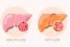 How to Reverse Grade 2 Fatty Liver? How to Reverse Grade 2 Fatty Liver?