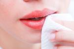 how to cure dark lips, tips to cure dark lips, home remedies to cure dark lips, Cure dark lips how to cure dark lips, tips to cure dark lips, home remedies to cure dark lips, Cure dark lips